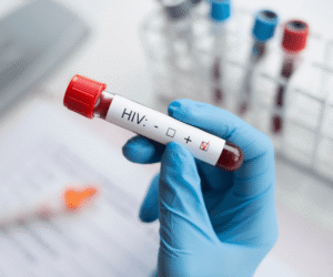 ¡Alerta en Tarija! confirman 17 casos de VIH y preocupa aumento en jóvenes